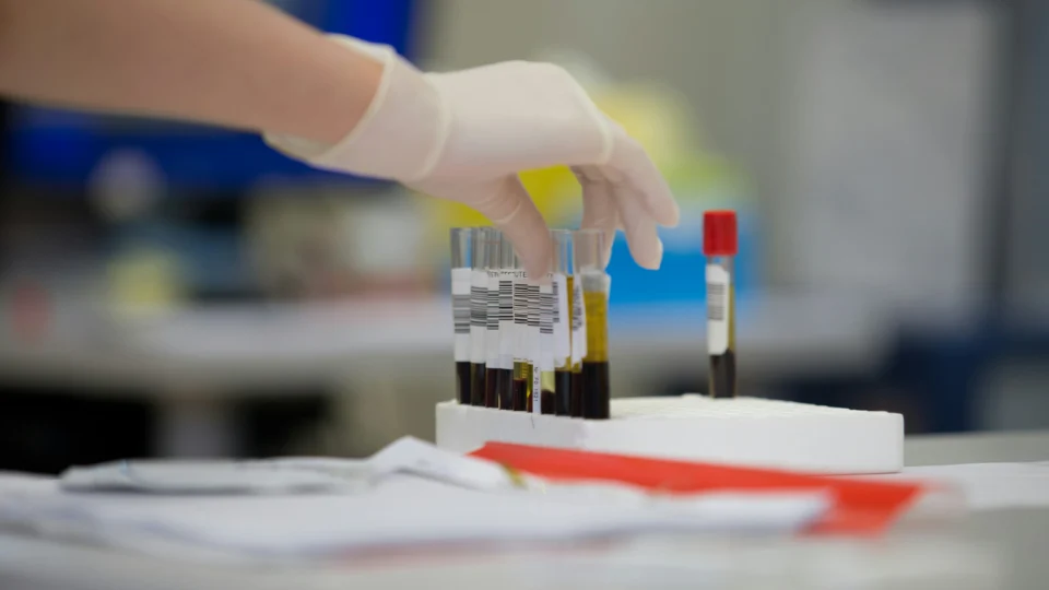 Novo exame de sangue que detecta 50 tipos de câncer busca sinais moleculares da doença antes do aparecimento de sintomas. (Foto: Adrian Sulyok/Unsplash)